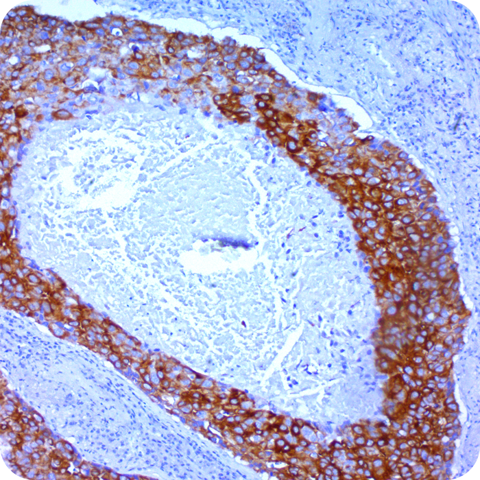 Cytokeratin 8; Clone K8/383 (Concentrate)